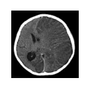 Exa RIS/PACS Multi-monitor