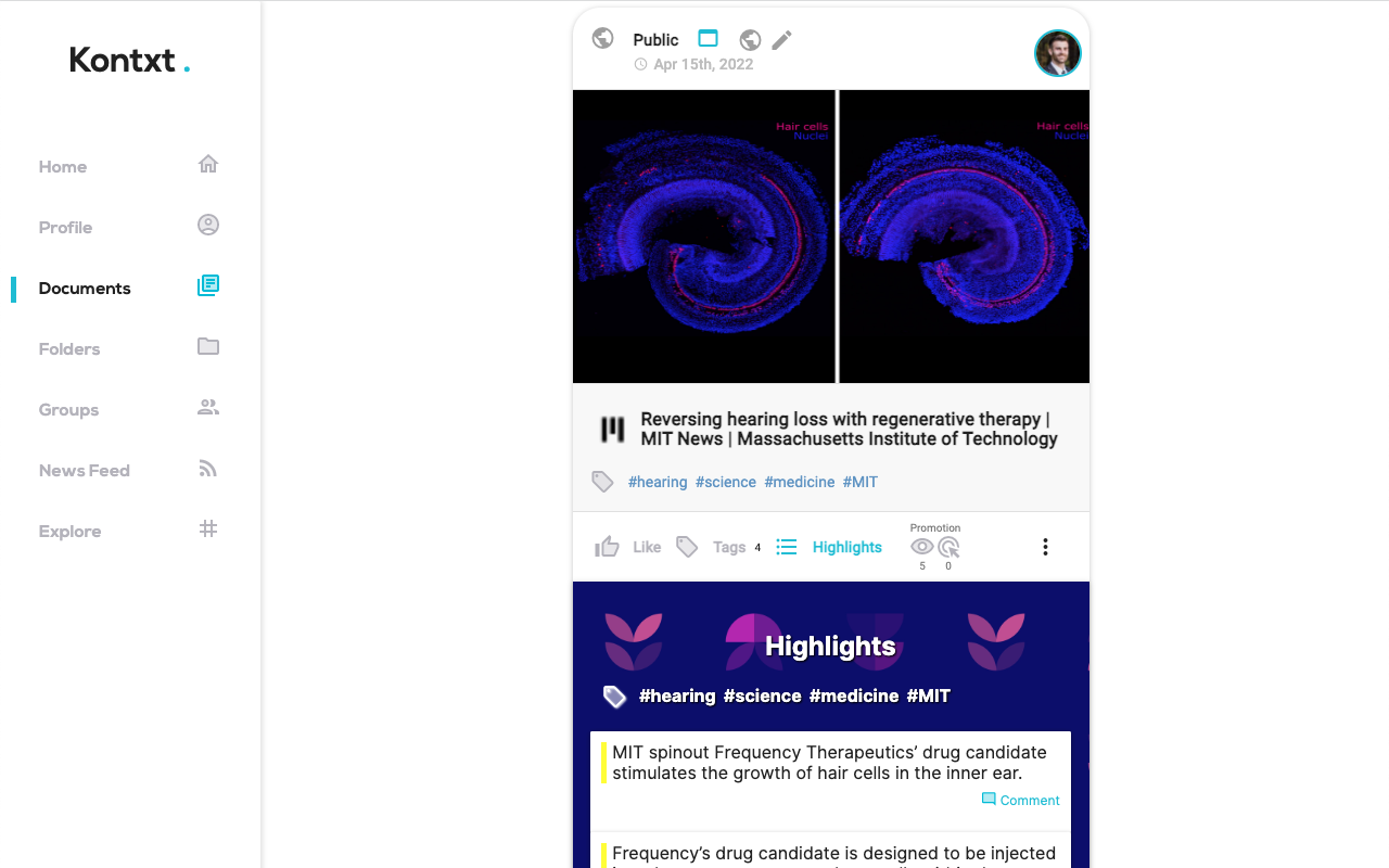 Kontxt – Social AI Memory Layer for the Web截图4