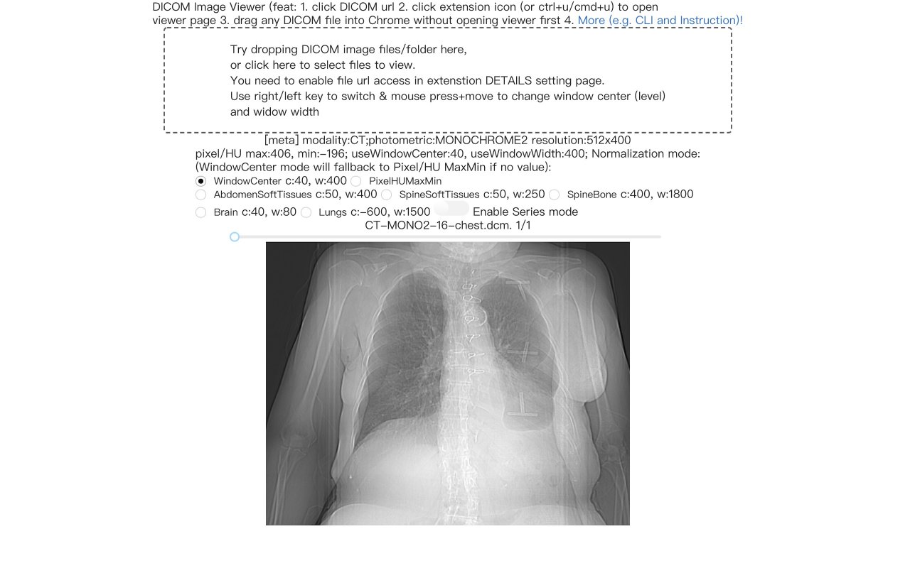 DICOM image viewer截图1