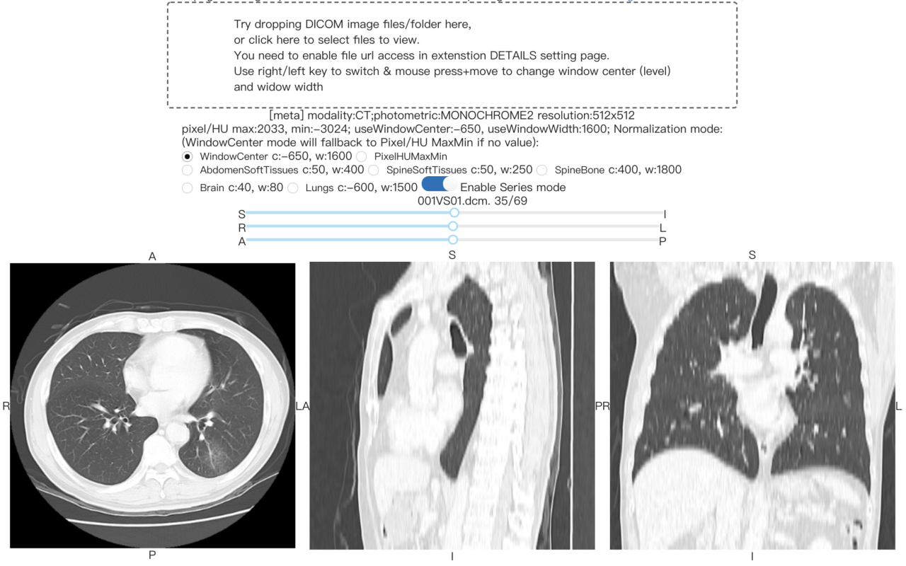 DICOM image viewer截图2