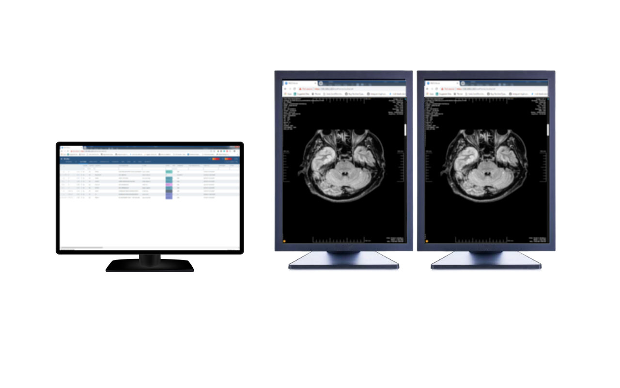 Exa RIS/PACS Multi-monitor截图1