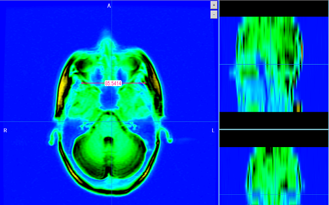 MRI Scalar截图1