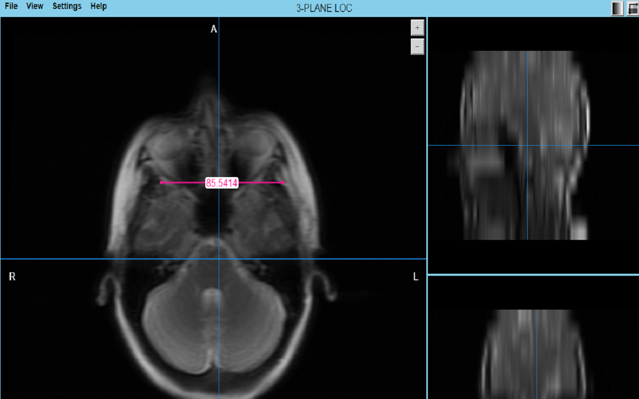 MRI Scalar截图2