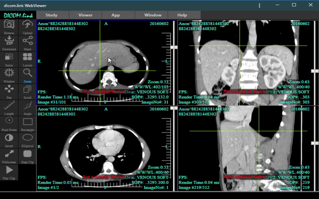 dicom.link Dicom Viewer截图1